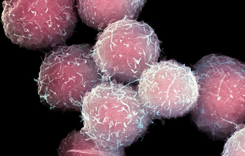 Electron Microscope image of Stem Cells